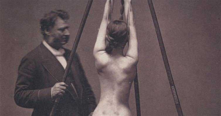 Fotos da medicina antiga que são assustadoras e fascinantes f9a2585ba83c5af89184c5b4e7f16ec1