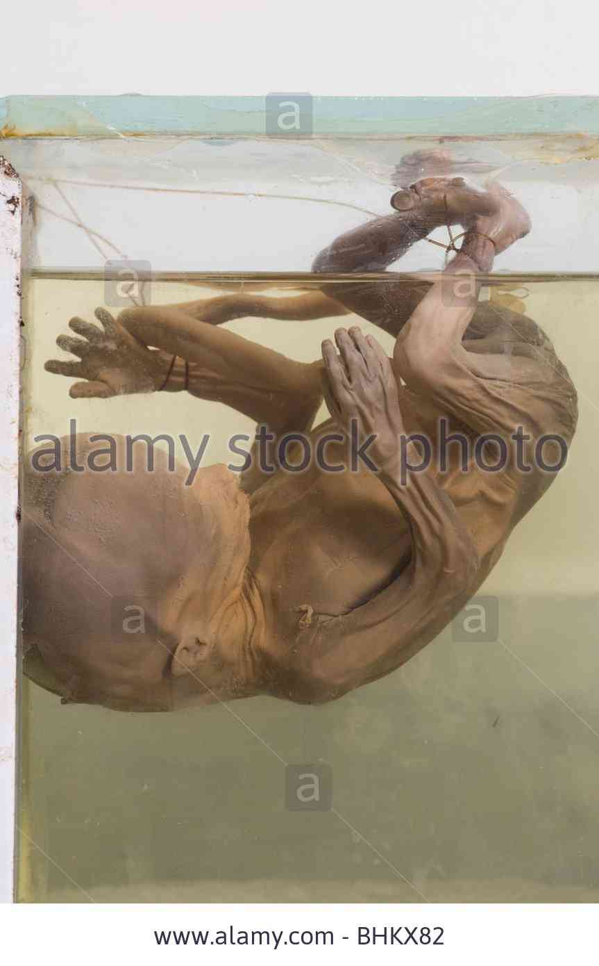 Feto alien no tubo fetus-preserved-in-a-glass-jar-BHKX82