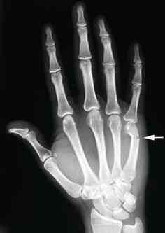 Investigadores independentes confirmam que a estranha múmia encontrada no deserto é de um extraterrestre. Será? b8e872526fc489ef29ed606e88cd73cb hand surgery hand anatomy | Bizarro | alien, aliens, Arqueologia, cruaturas, jaime maussan, polêmica, ufologia, ufos